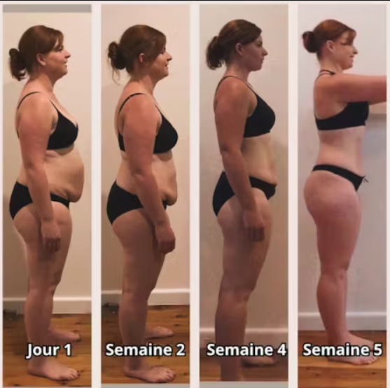 Vibru® Sculpteur de Peau