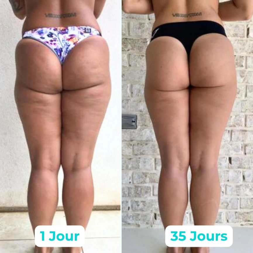 Vibru® Sculpteur de Peau