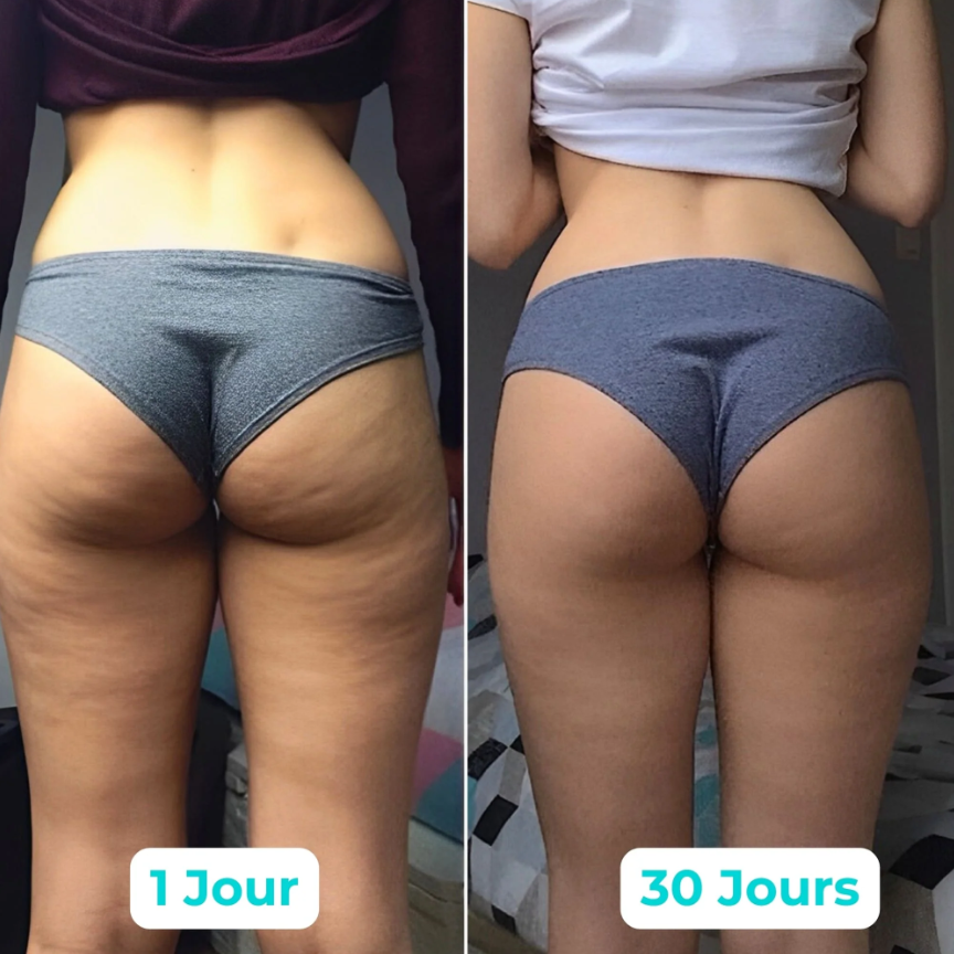 Vibru® Sculpteur de Peau